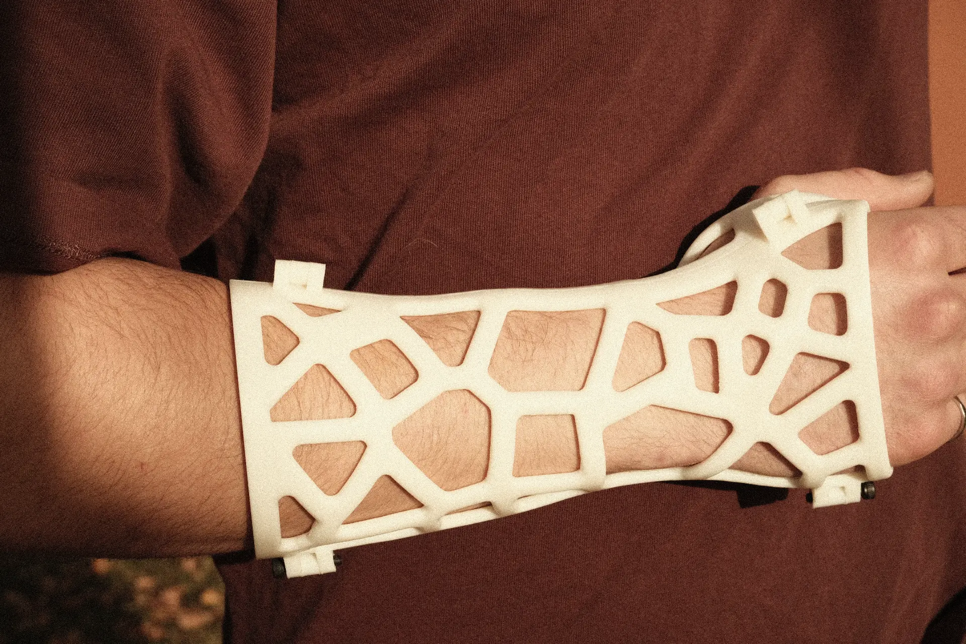 Cream-coloured 3D-printed lattice cast worn on a person's forearm and wrist, its open web pattern assembled in two halves joined at dark fasteners